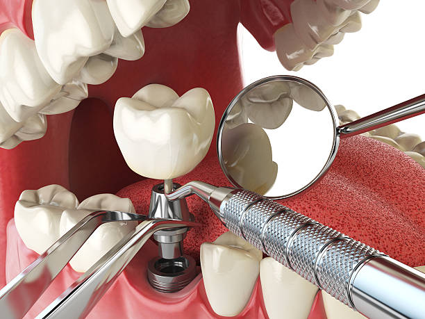 Best Tooth Pain Emergency Relief  in Forest Hills, TN